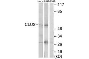 Western blot analysis of extracts from HeLa cells/A549 cells, using CLUS Antibody. (Clusterin anticorps  (AA 400-449))