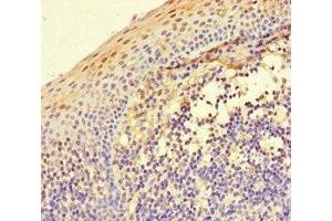 Immunohistochemistry of paraffin-embedded human tonsil tissue using ABIN7156438 at dilution of 1:100 (ITGA4 anticorps  (AA 376-558))