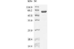 (Tris-Glycine gel) Discontinuous SDS-PAGE (reduced) with 5 % enrichment gel and 15 % separation gel.