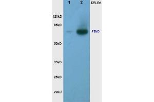 L1 human rectal carcinoma lysates L2 human gastric carcinoma lysates, probed with Anti Phospho-Torc2/Crtc2(Ser171) Polyclonal Antibody, Unconjugated (ABIN745988) at 1:200 overnight at 4 °C.