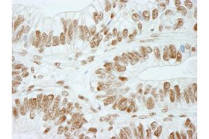 Immunohistochemistry (IHC) image for anti-Retinoblastoma Binding Protein 5 (RBBP5) (C-Term) antibody (ABIN7448757)