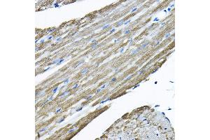 Immunohistochemistry of paraffin-embedded mouse heart using UBE2F Rabbit pAb  at dilution of 1:200 (40x lens).