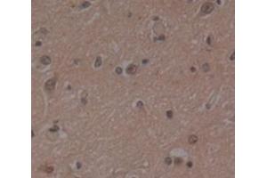 Used in DAB staining on fromalin fixed paraffin- embedded Kidney tissue