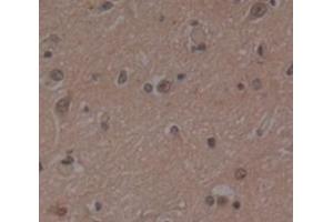 Used in DAB staining on fromalin fixed paraffin- embedded Kidney tissue (PSMD4/ASF anticorps  (AA 1-377))