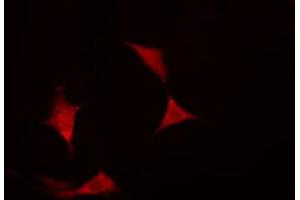 ABIN6274408 staining COLO205 cells by IF/ICC.