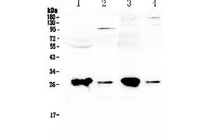 Western blot analysis of GSTT1 using anti-GSTT1 antibody . (GSTT1 anticorps  (AA 3-231))
