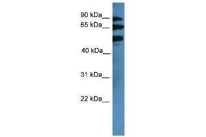 WB Suggested Anti-BBS2 Antibody Titration: 0. (BBS2 anticorps  (Middle Region))