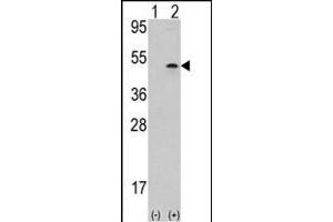 Western blot analysis of AURKB (arrow) using rabbit polyclonal Aurora-B (ARK/STK12) Antibody (Center) (ABIN391354 and ABIN2841375). (Aurora-B (ARK/STK12) (AA 283-313) anticorps)