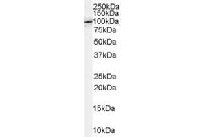 Western Blotting (WB) image for anti-Amyloid beta (A4) Precursor Protein-Binding, Family B, Member 1 (Fe65) (APBB1) (C-Term) antibody (ABIN2465409) (FE65 anticorps  (C-Term))