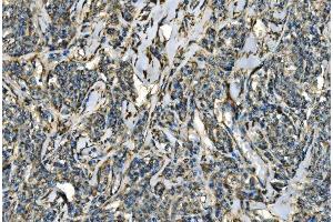 IHC analysis of CX3CR1 using anti-CX3CR1 antibody (ABIN7599293). (CX3CR1 anticorps  (AA 1-345))