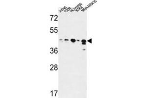 Western Blotting (WB) image for anti-Alcohol Dehydrogenase 7 (Class IV), mu Or sigma Polypeptide (ADH7) antibody (ABIN3004285) (ADH7 anticorps)