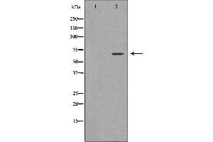 Western blot analysis of K562 whole cell lysates, using PIAS2 Antibody. (PIAS2 anticorps  (N-Term))