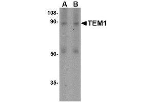 Image no. 1 for anti-CD248 Molecule, Endosialin (CD248) (N-Term) antibody (ABIN1494342) (CD248 anticorps  (N-Term))