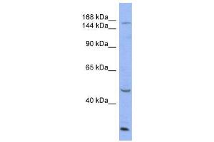 WB Suggested Anti-ATP7A  Antibody Titration: 0. (ATP7A anticorps  (Middle Region))