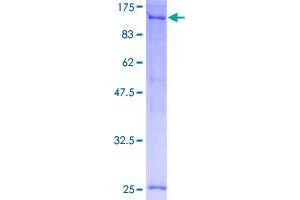 Image no. 1 for Tuftelin Interacting Protein 11 (TFIP11) (AA 1-837) protein (GST tag) (ABIN1322579)