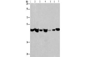 Western Blotting (WB) image for anti-Adipocyte Plasma Membrane Associated Protein (APMAP) antibody (ABIN2431985)
