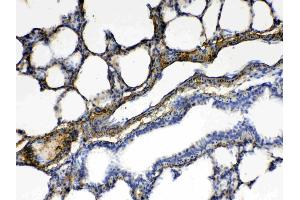 IHC analysis of CPI17 alpha using anti- CPI17 alpha antibody .