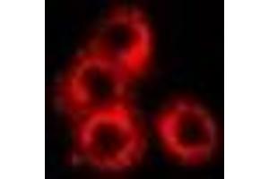 anti-Syntaxin Binding Protein 2 (STXBP2) antibody