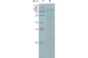 Human (23-617) Protein, His Tag on SDS-PAGE under reducing condition.