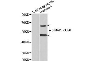 Western Blotting (WB) image for anti-Microtubule-Associated Protein tau (MAPT) (pSer396) antibody (ABIN1870397) (MAPT anticorps  (pSer396))