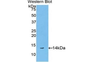 Western blot analysis of the recombinant protein. (Biglycan anticorps  (AA 48-158))