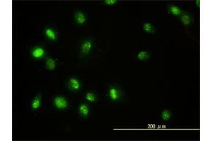 Immunofluorescence of monoclonal antibody to STAT5B on HeLa cell.