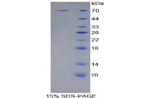 SDS-PAGE analysis of Human KIR2DL2 Protein.