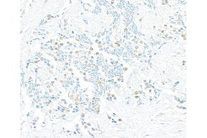 anti-PDS5, Regulator of Cohesion Maintenance, Homolog B (PDS5B) (C-Term) antibody