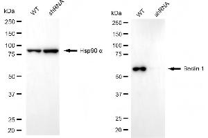 Western blotting analysis using beclin 1 antibody (ABIN7797760).