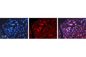 Rabbit Anti-CREB1 Antibody Catalog Number: ARP31264_T100 Formalin Fixed Paraffin Embedded Tissue: Human Testis Tissue Observed Staining: Nucleus Primary Antibody Concentration: 1:100 Other Working Concentrations: N/A Secondary Antibody: Donkey anti-Rabbit-Cy3 Secondary Antibody Concentration: 1:200 Magnification: 20X Exposure Time: 0.