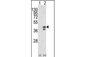 Western blot analysis of GOT1 (arrow) using rabbit polyclonal GOT1 Antibody (N-term) (ABIN650769 and ABIN2839550).