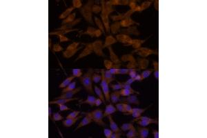 Immunofluorescence analysis of HeLa cells using UGT2B7 Polyclonal Antibody (ABIN6132908, ABIN6149903, ABIN6149904 and ABIN6218790) at dilution of 1:100 (40x lens). (UGT2B7 anticorps  (AA 25-351))