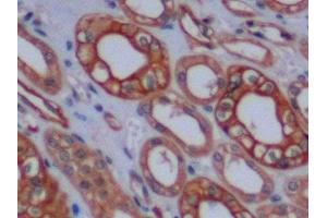 Detection of CK8 in Human Kidney Tissue using Polyclonal Antibody to Cytokeratin 8 (CK8)