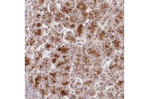 Immunohistochemical staining of human pancreas with FAM204A polyclonal antibody  shows strong cytoplasmic and nuclear positivity in exocrine glandular cells. (FAM204A anticorps)