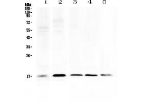 Western blot analysis of Psoriasin using anti-Psoriasin antibody . (S100A7 anticorps  (AA 2-101))