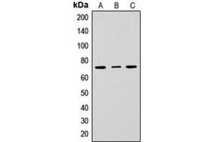Western blot analysis of CD229 expression in HepG2 (A), Raw264. (LY9 anticorps  (Center))