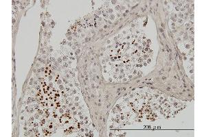 Immunoperoxidase of monoclonal antibody to TNP1 on formalin-fixed paraffin-embedded human testis.