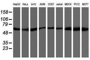 Image no. 7 for anti-V-Akt Murine Thymoma Viral Oncogene Homolog 1 (AKT1) antibody (ABIN1496556) (AKT1 anticorps)
