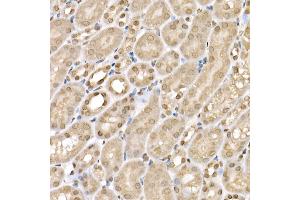 Immunohistochemistry of paraffin-embedded mouse kidney using SLC14 Rabbit pAb (5991) at dilution of 1:200 (40x lens). (SLC14A1 anticorps  (C-Term))