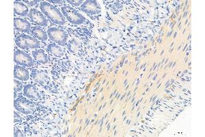 ABIN6263660 and ABIN6272968 at 1/100 staining Rat colon tissue by IHC-P.