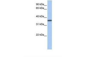 Image no. 1 for anti-UDP-Galactose-4-Epimerase (GALE) (N-Term) antibody (ABIN6738942) (GALE anticorps  (N-Term))
