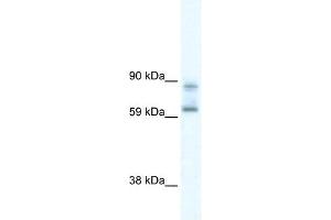 DDX42 antibody used at 5 ug/ml to detect target protein. (DDX42 anticorps)