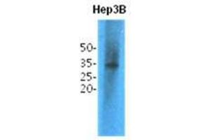 Western Blotting (WB) image for anti-Thiopurine S-Methyltransferase (TPMT) antibody (ABIN781549)