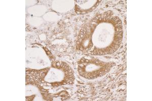 Immunohistochemistry (IHC) image for anti-Protein Disulfide Isomerase Family A, Member 3 (PDIA3) (AA 25-75) antibody (ABIN7453943)