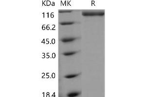 Western Blotting (WB) image for Selectin E (SELE) (Active) protein (Fc Tag) (ABIN7197867) (Selectin E/CD62e Protein (Fc Tag))