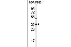 Western blot analysis in MDA-MB231 cell line lysates (35ug/lane). (TPSD1 anticorps  (C-Term))