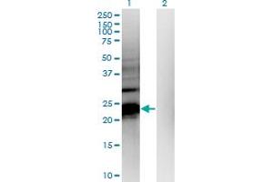 Western Blot analysis of HDHD1A expression in transfected 293T cell line by HDHD1A monoclonal antibody (M05), clone 4F12. (HDHD1 anticorps  (AA 107-212))