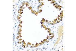 Immunohistochemistry of paraffin-embedded mouse lung using NRG4 antibody at dilution of 1:100 (40x lens). (Neuregulin 4 anticorps)