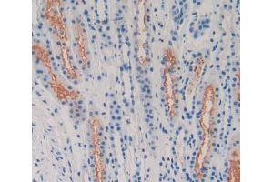 Used in DAB staining on fromalin fixed paraffin- embedded Kidney tissue (LPHN2 anticorps  (AA 139-398))