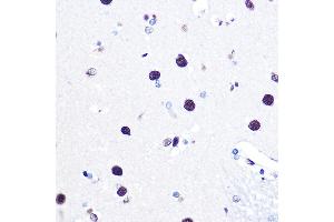 Immunohistochemistry of paraffin-embedded human brain using hnRNP C Rabbit pAb (ABIN7267630) at dilution of 1:100 (40x lens). (HNRNPC anticorps)